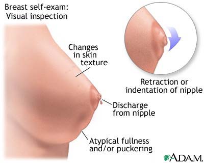 Breast self-exam