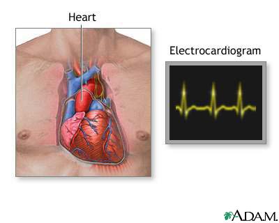 Electrocardiogram (ECG)