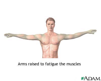 Muscle fatigue