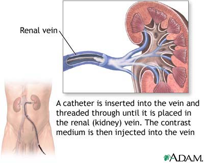 Renal veins