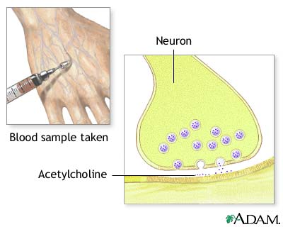 Cholinestrase test